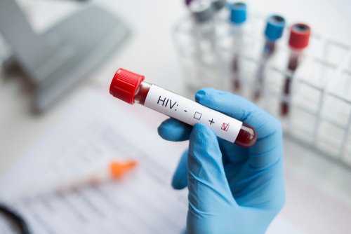 Hand holding in hand a positive HIV test