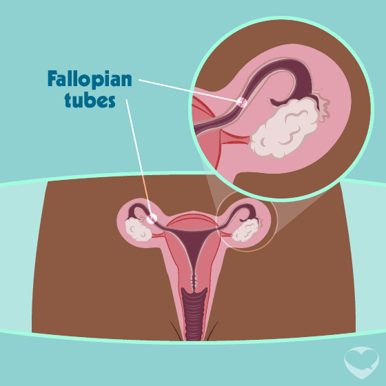 fallopian tubes