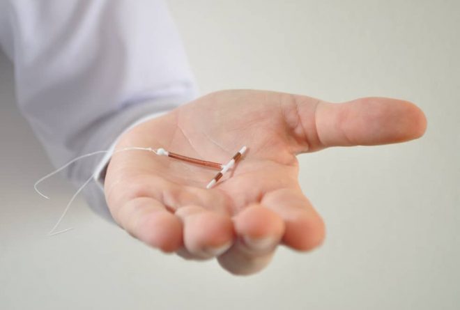 The Copper-T IUD: top facts